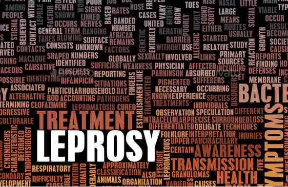 Leprosy