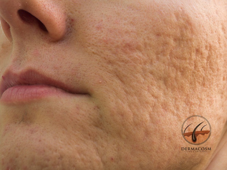 Cosmetic Dermatology